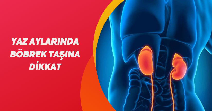 Yaz aylarında böbrek taşına dikkat