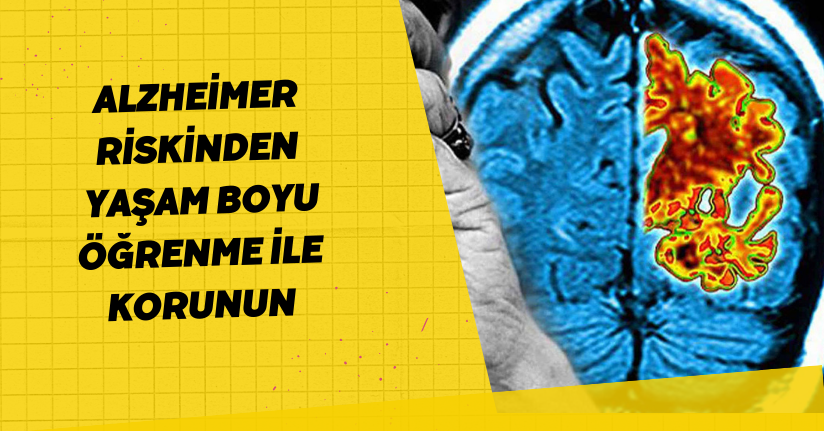 Alzheimer riskinden yaşam boyu öğrenme ile korunun