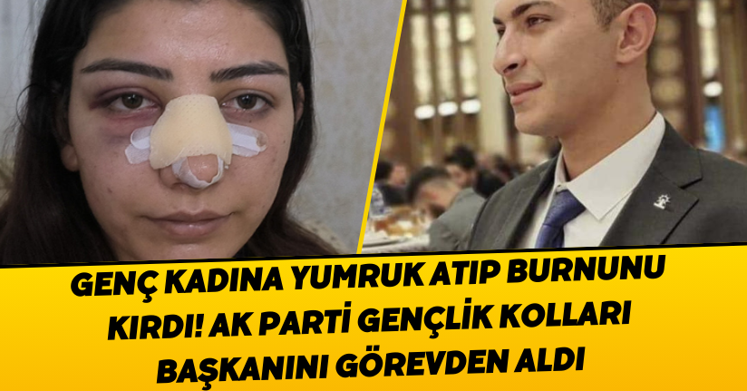 Genç kadına yumruk atıp burnunu kırdı! AK Parti, gençlik kolları başkanını görevden aldı