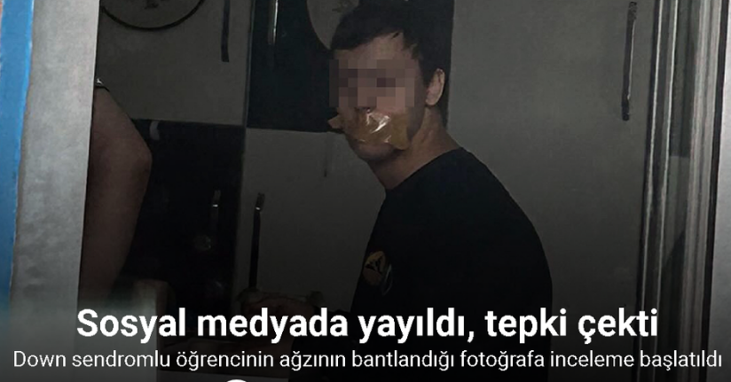 Down sendromlu öğrencinin ağzının bantlandığı fotoğrafa inceleme başlatıldı