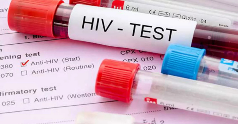 HIV’de artış; 15-24 yaş grubunda daha fazla