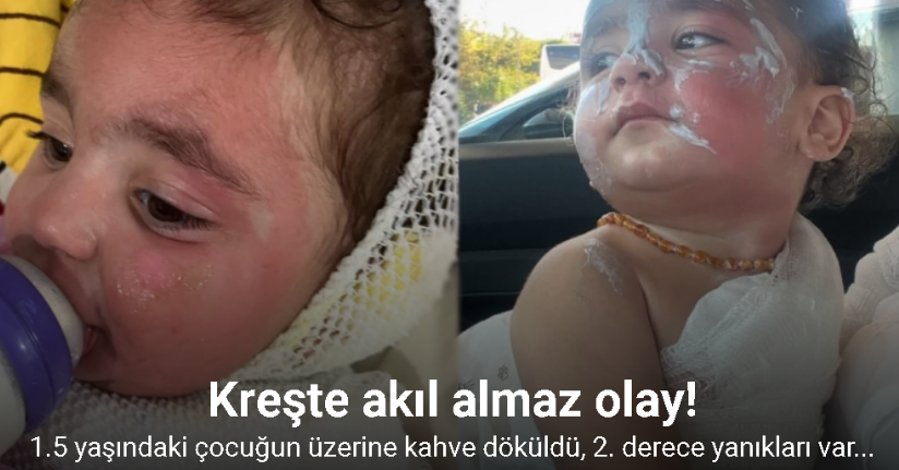 Kreşte çocuğun üzerine kahve döküldü