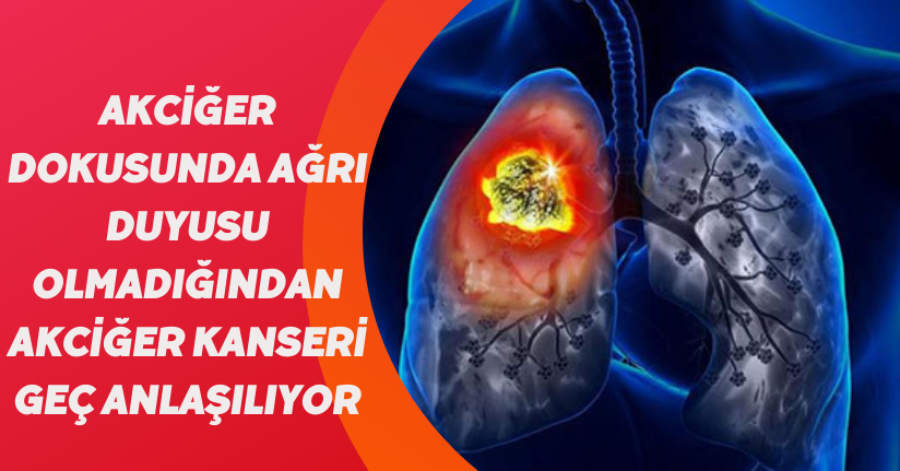 Akciğer dokusunda ağrı duyusu olmadığından akciğer kanseri geç anlaşılıyor