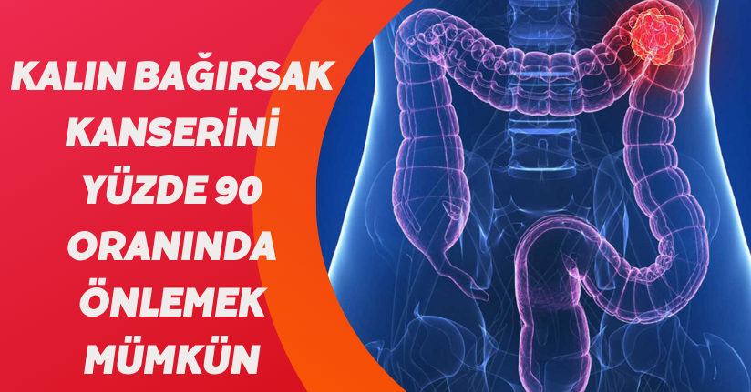 Kalın bağırsak kanserini yüzde 90 oranında önlemek mümkün