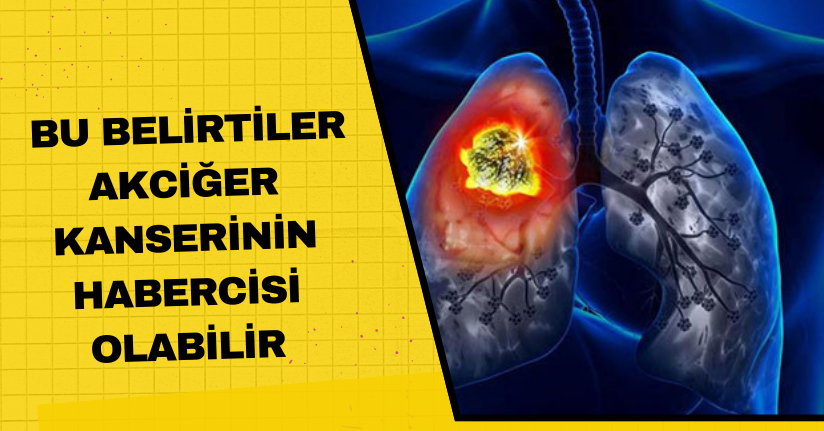 Bu belirtiler, akciğer kanserinin habercisi olabilir