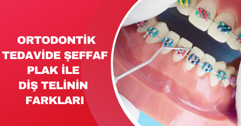 Ortodontik tedavide şeffaf plak ile diş telinin farkları