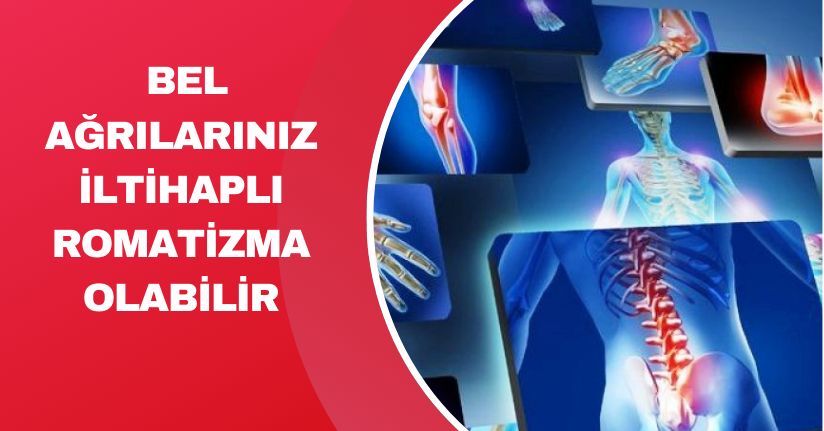 Bel ağrılarınız iltihaplı romatizma olabilir