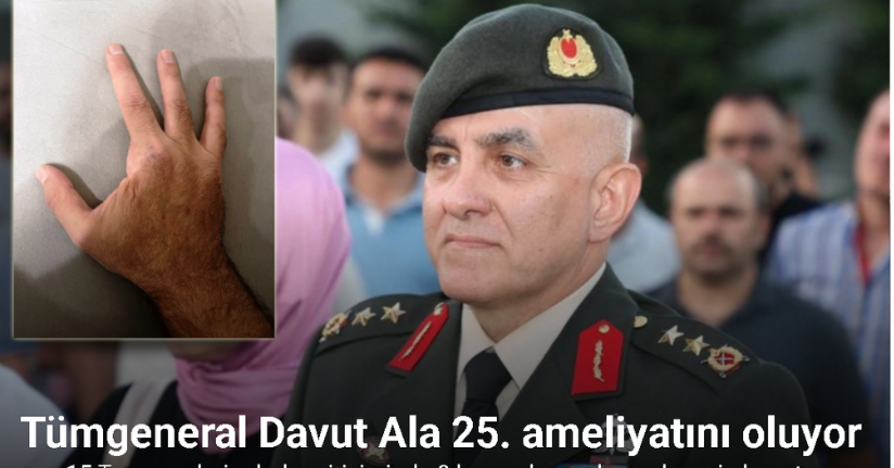 15 Temmuz Gazisi Tümgeneral Davut Ala 25. ameliyatını oluyor