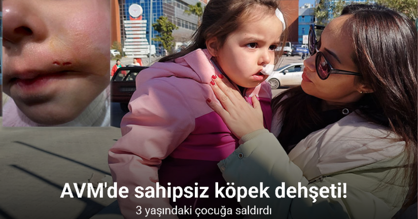 İzmir’de AVM’deki sahipsiz köpek 3 yaşındaki Elif’e saldırdı