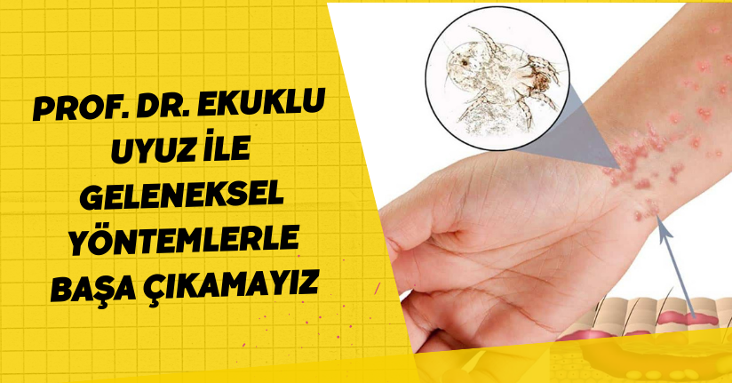 Prof. Dr. Ekuklu: Uyuz ile geleneksel yöntemlerle başa çıkamayız