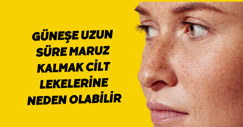 Güneşe uzun süre maruz kalmak cilt lekelerine neden olabilirGüneşe uzun süre maruz kalmak cilt lekelerine neden olabilir