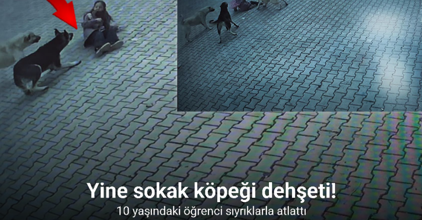 10 yaşındaki öğrenci köpeklerin saldırısını sıyrıklarla atlattı