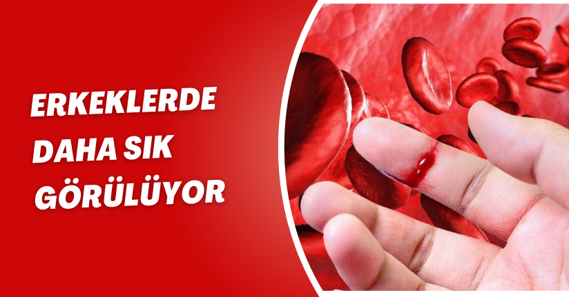 Erkeklerde daha sık görülüyor
