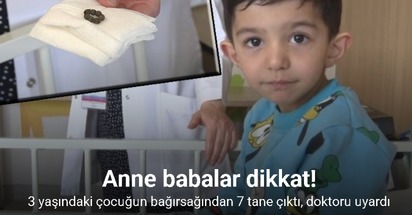 3 yaşındaki çocuğun bağırsağından 7 tane mıknatıs çıktı