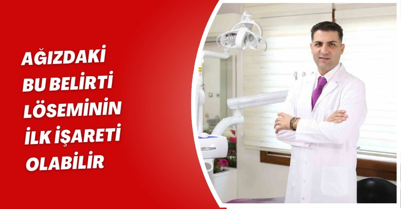 Ağızdaki bu belirti löseminin ilk işareti olabilir