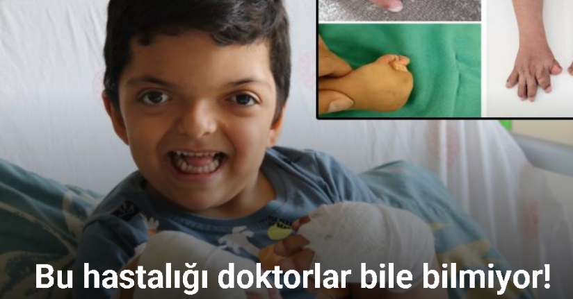 Doktorların ismini yeni duyduğu rahatsızlık Eskişehir’de tedavi edildi, 10 parmağı açıldı