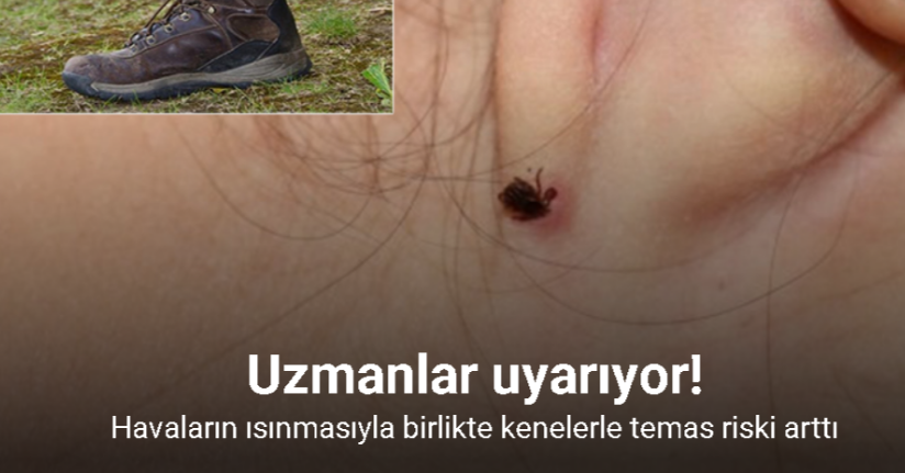 Havaların ısınmasıyla birlikte kenelerle temas riski arttı