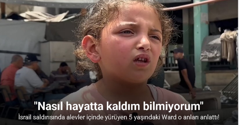 İsrail saldırısında alevler içinde yürüyen 5 yaşındaki Ward: 