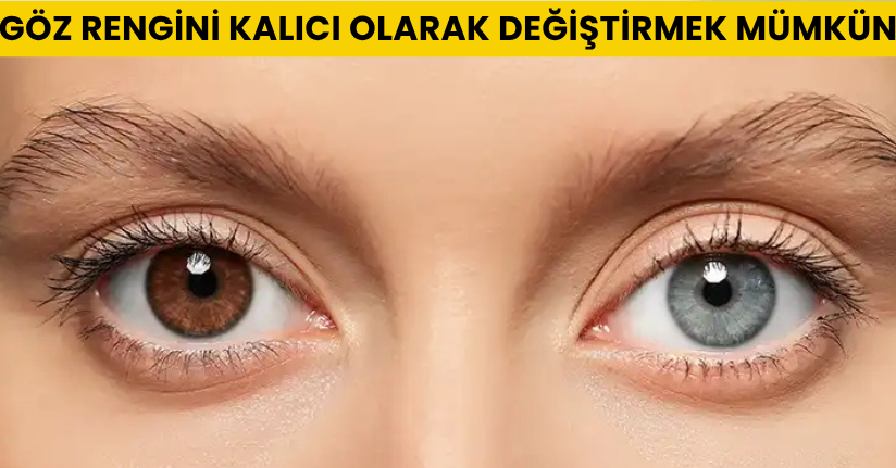 Göz rengini kalıcı olarak değiştirmek mümkün