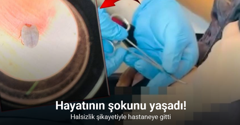 Hastaneye gitti, karnına yapışan kene ile karşılaştı