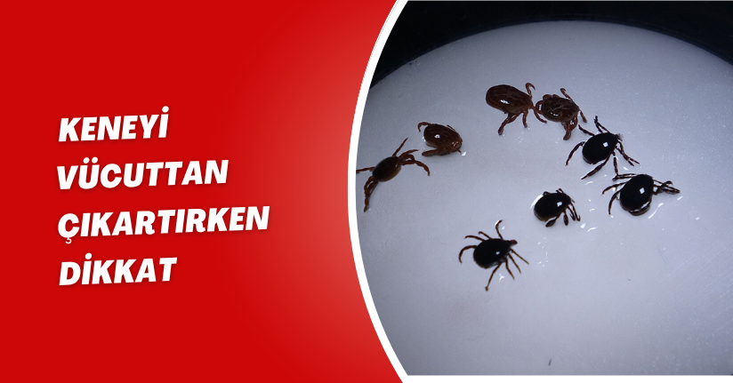 Keneyi vücuttan çıkartırken dikkat