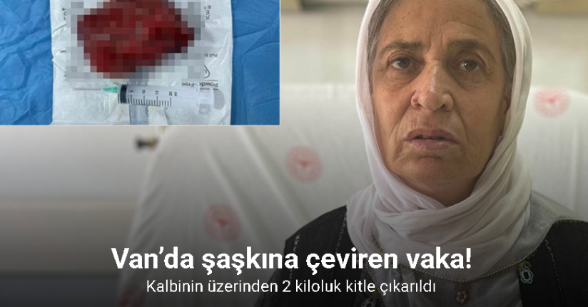 Kalbinin üzerinden 2 kiloluk kitle çıkarıldı