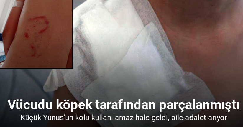Vücudu köpek tarafından parçalanan Yunus’un kolu kullanılamaz hale geldi, aile adalet arıyor