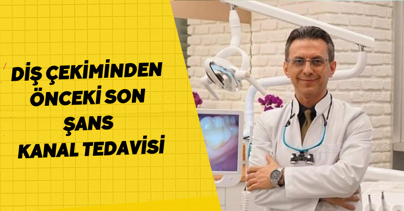  Diş çekiminden önceki son şans: Kanal tedavisi