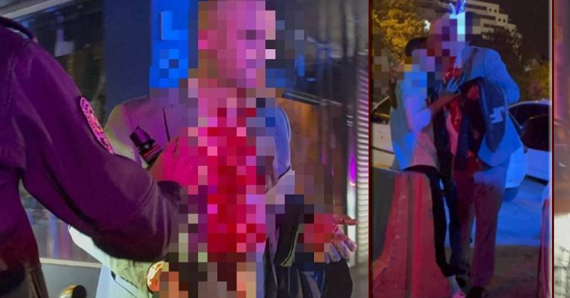 Eğlencenin sonu kötü bitti: Baba oğul yaralandı