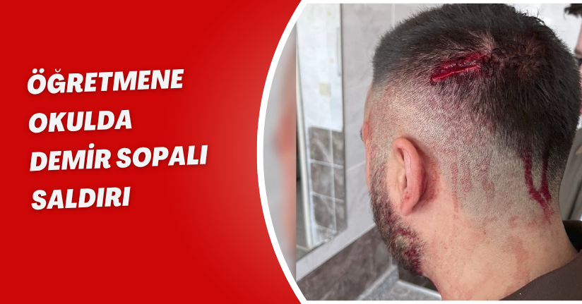 Öğretmene okulda demir sopalı saldırı