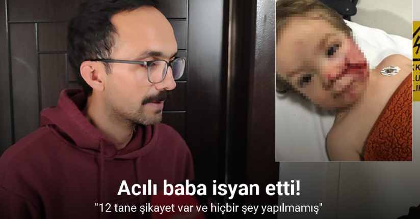 Ankara’da çocuklarına pitbull saldıran acılı baba isyan etti