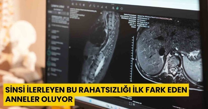 Sinsi ilerleyen bu rahatsızlığı ilk fark eden anneler oluyor