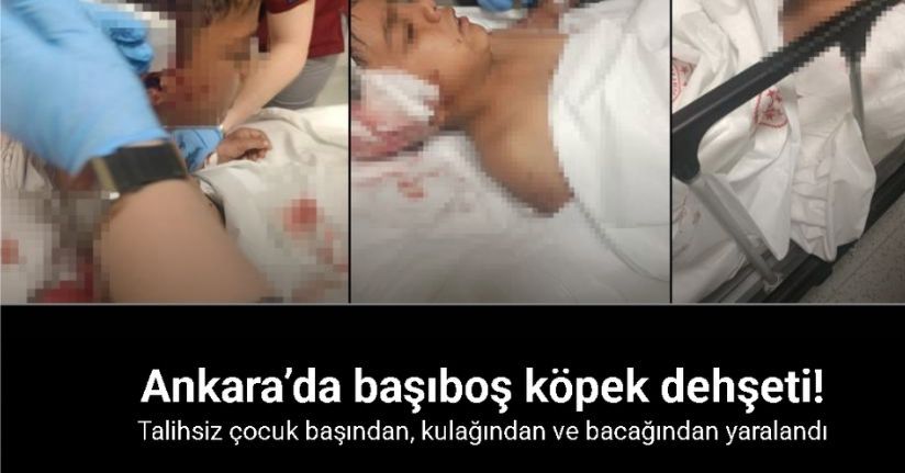 Ankara’da sokak köpeğinin saldırısına uğrayan çocuk yaralandı