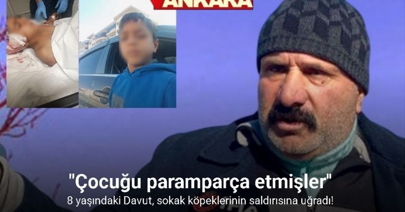 Köpeklerin saldırısına uğrayan çocuğu kurtaran komşu