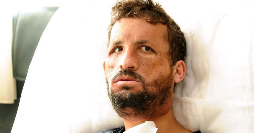 Hayata 14 yıldır başka bir yüzle bakıyor