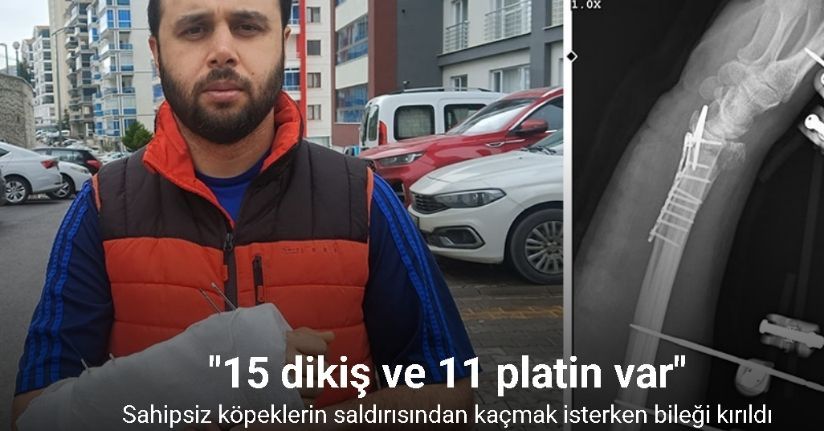 Sahipsiz köpeklerin saldırısından kaçmak isterken bileği kırıldı