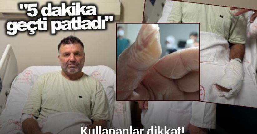 Sıcak su torbasının patlamasıyla vücudunun yüzde 30’u yandı: 