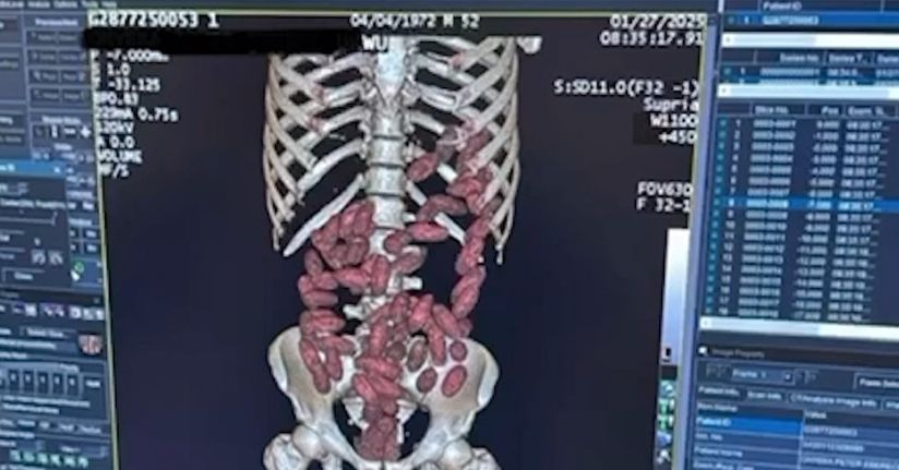 2025’te İstanbul Havalimanı’nda ‘yutucu’ kuryelerden 29,7 kilo uyuşturucu ele geçirildi