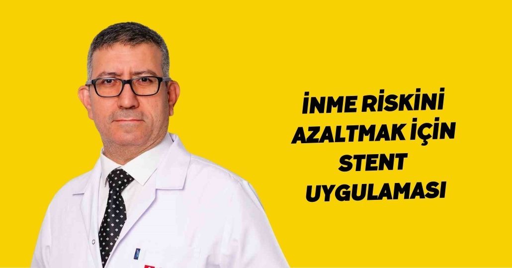 İnme riskini azaltmak için stent uygulaması