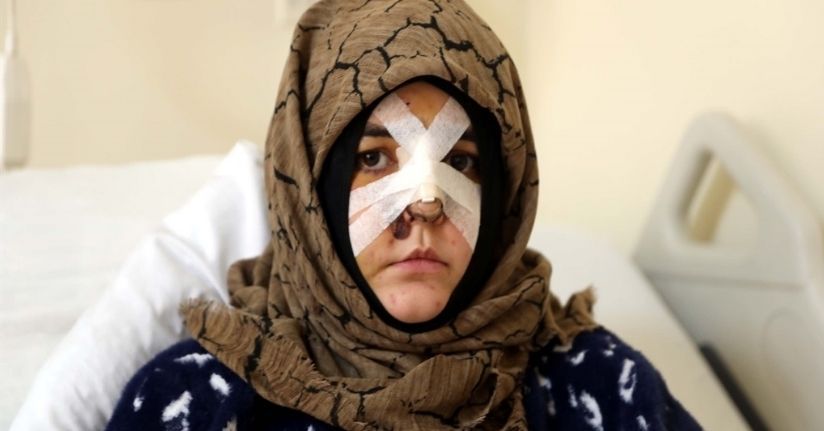 Boşanma aşamasındaki eşine vurduğu kaldırım taşı 'silah' sayıldı