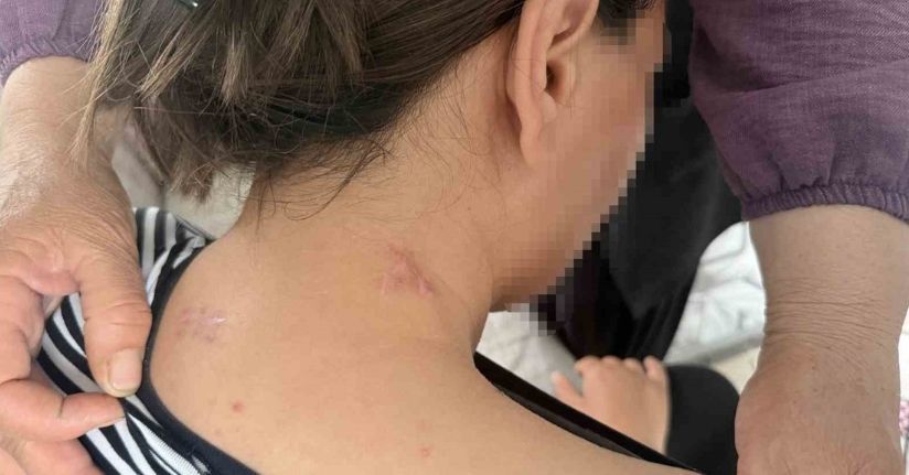 17 bıçak darbesi aldı, ölü numarasıyla kurtuldu, kocasının en ağır cezayı almasını istedi