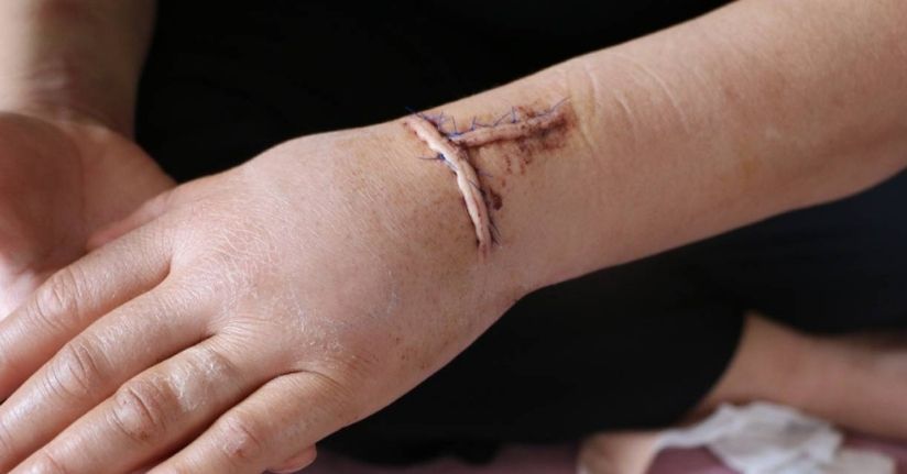 Diyarbakır’da dehşet: Nikahlı eşini 30 yerinden bıçakladı