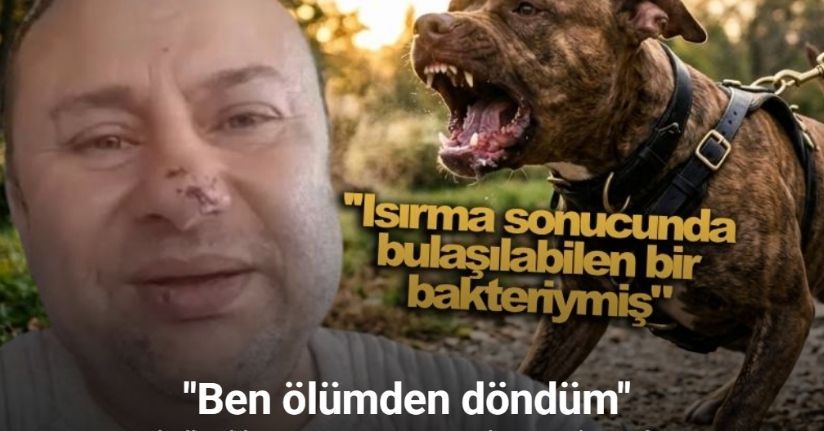 Pitbull saldırısına uğrayan Onur Akay o anları anlattı: 