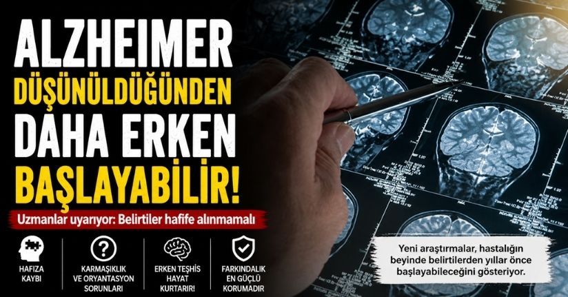 Alzheimer düşünüldüğünden daha erken başlayabilir