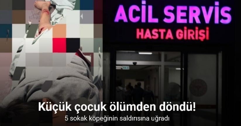 Van’da sokak köpeği dehşeti: 11 yaşındaki çocuk parçalanmaktan son anda kurtuldu