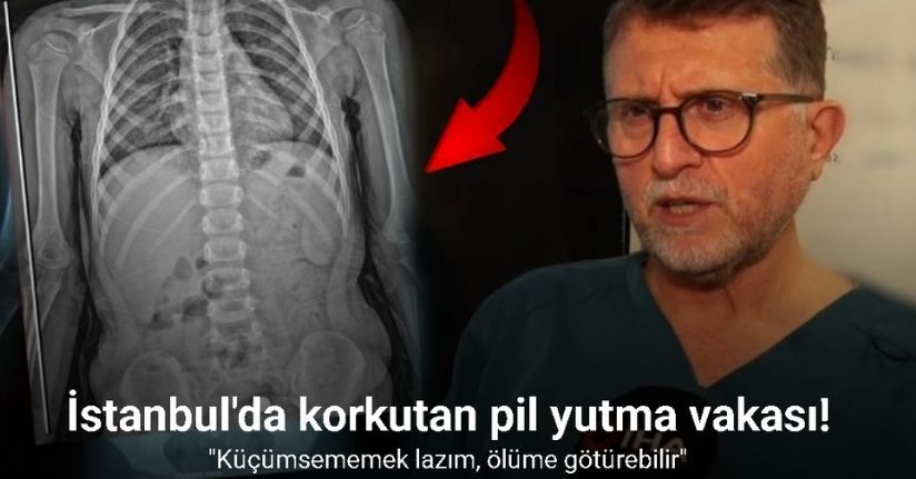 Şeker sanıp yuttu, pil olduğu filmde ortaya çıktı: 