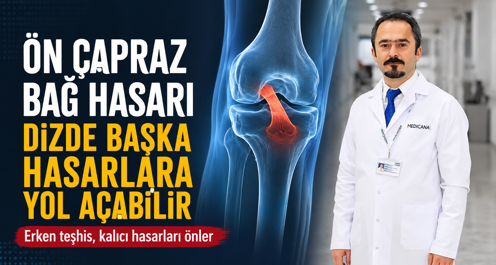 Ön çapraz bağ hasarı dizde başka hasarlara yol açabilir