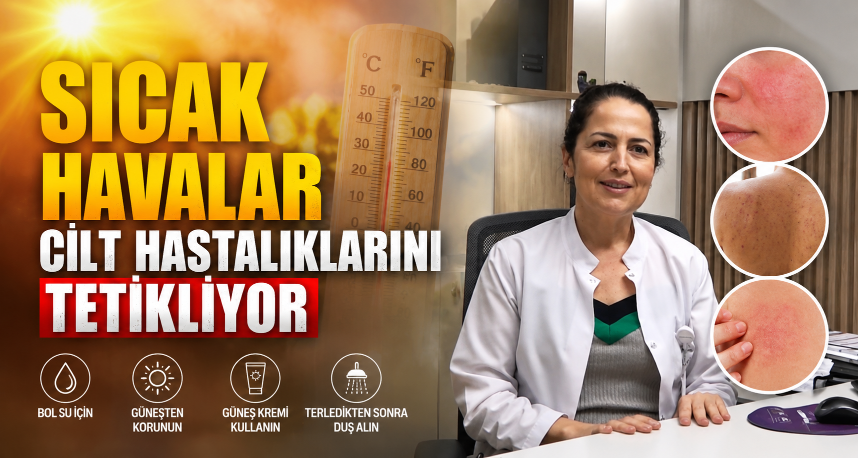 Sıcak havalar cilt hastalıklarını tetikliyor