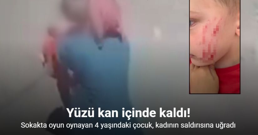 Van’da sokakta oynayan çocuğa saldırı: O anlar kamerada
