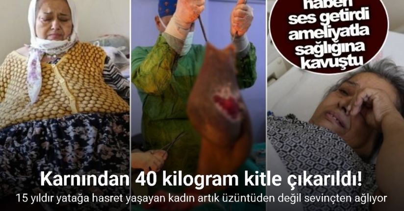 Karnından 40 kilogram kitle çıkarıldı